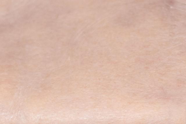 Epidermis